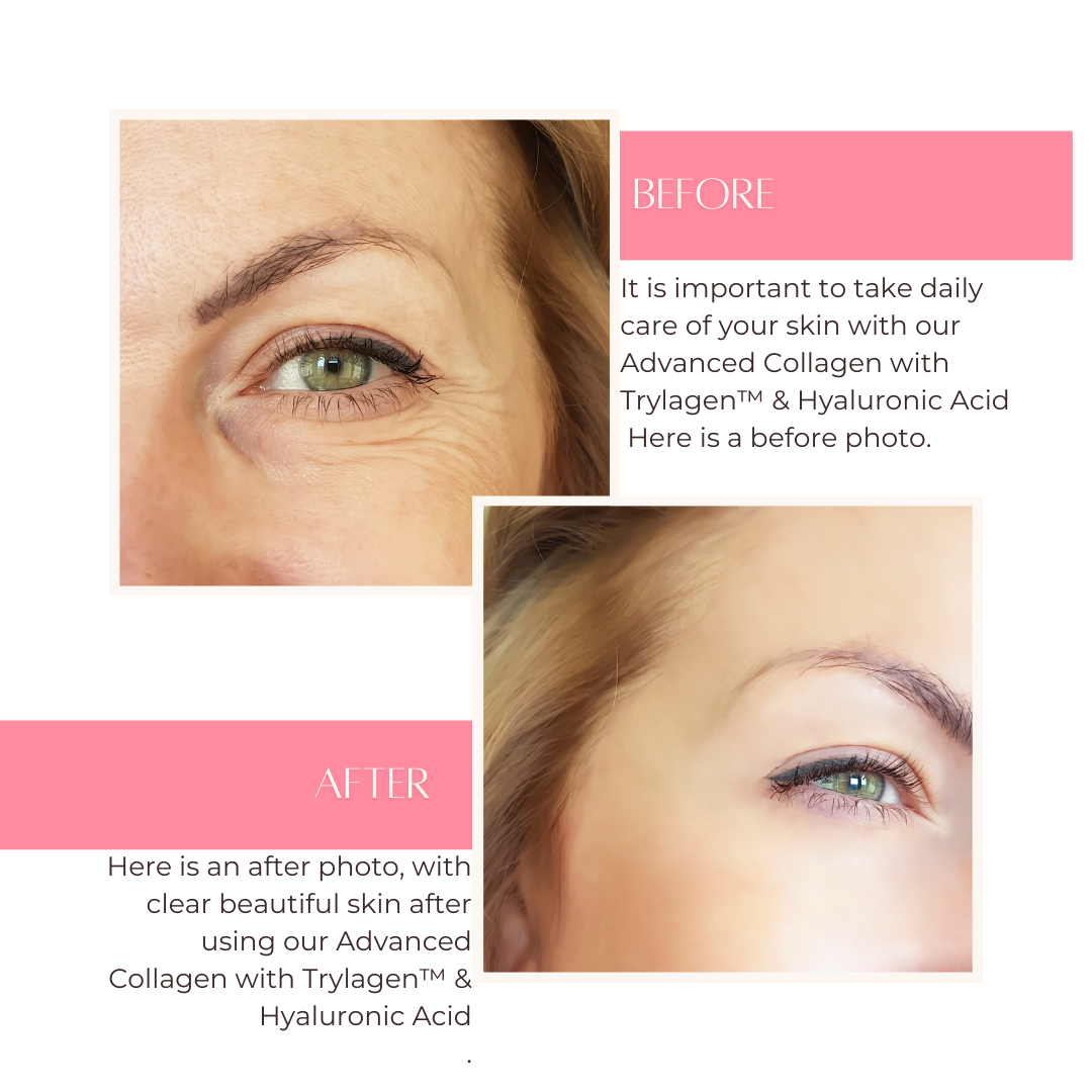 Advanced Collagen with Trylagen® and Hyaluronic Acid