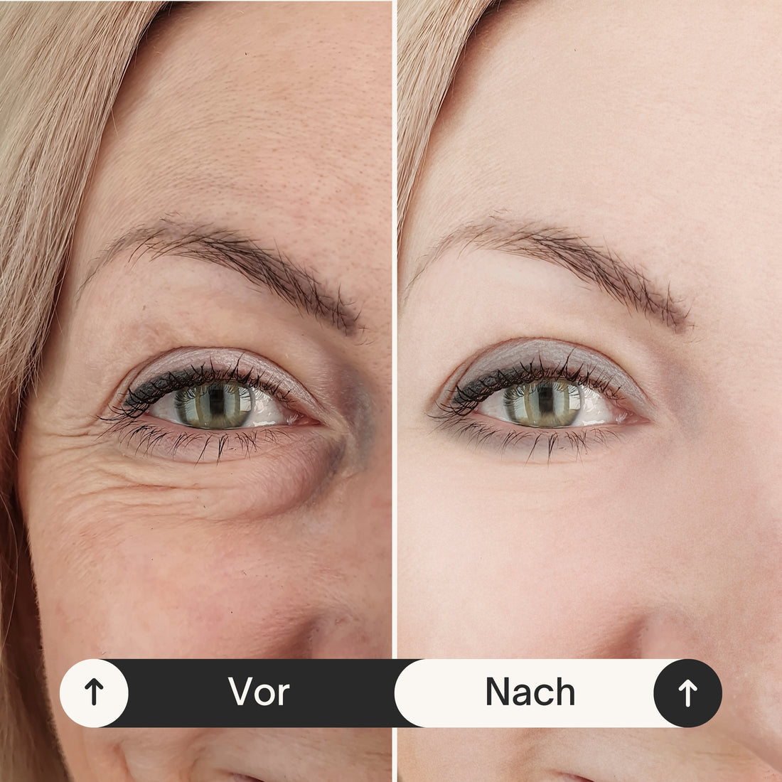 Advanced Collagen with Trylagen® and Hyaluronic Acid